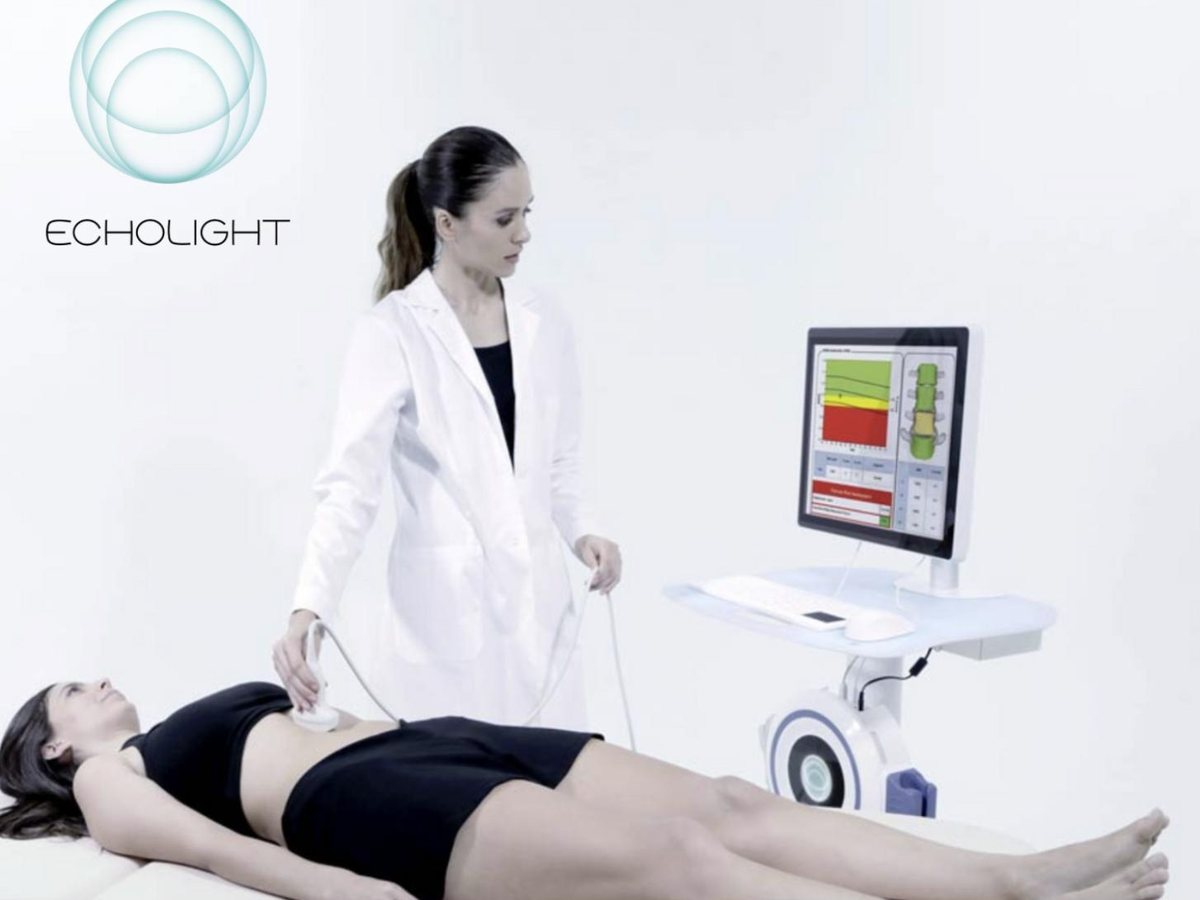 Echolight REMS probe scanning a patient's spine with results on screen